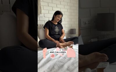 Heal Dry & Cracked Heels with Foobetik Cream | Special Foot Care Solution