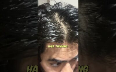 Best hair care routine for men | Hair fall | Hair loss
